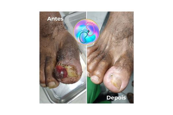 Foto de antes e depois do tratamento 46
